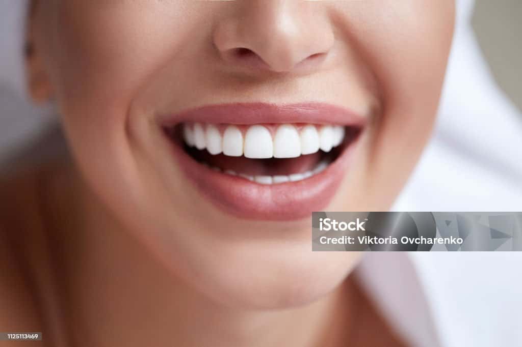 laser-teeth-whitening